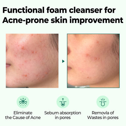 Some By Mi AHA BHA PHA 30 Days Miracle Acne Clear Foam 100ml